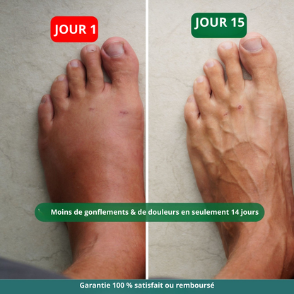 Chaussettes de contention larges Maisoya™ pour soulager la douleur